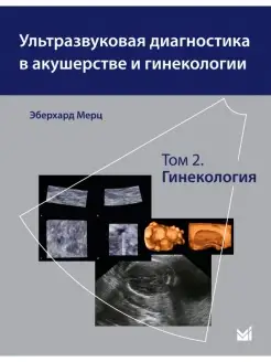 Ультразвуковая диагностика в акушерстве и гинекологии. Т.2