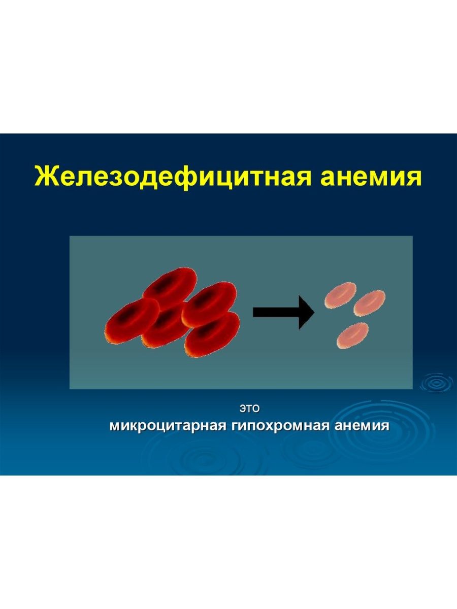 Анемия железа. Железнодефецитная Анимия. Железодефицитная анемия клинические рекомендации. Анемия у детей клинические рекомендации. Жда клинические рекомендации.