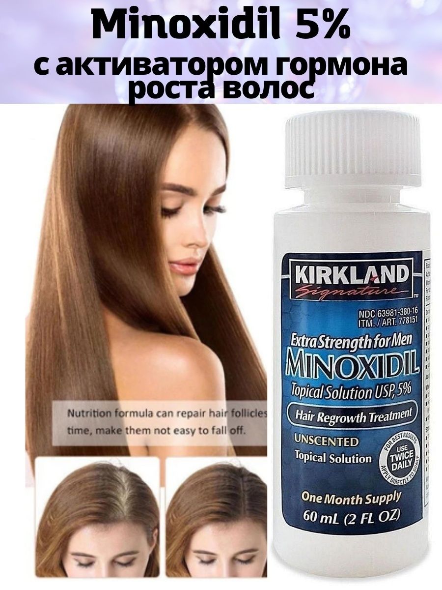 Миноксидил цена отзывы. Миноксидил 5 для волос. Миноксидил для волос 10℅. Миноксидил для волос для женщин. Миноксидил 05 для волос.