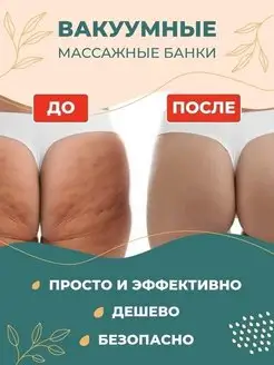 Банки вакуумные массажные